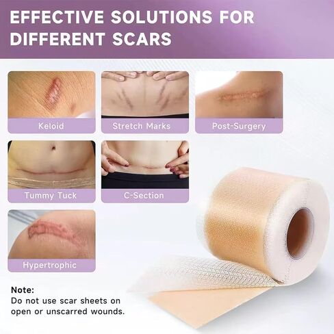 Silicone Scar Tape,Silicone Scar Sheets,Scar Tape For Surgical Scars,Silicone Scar Removal Strips For Surgical,C-Section,Tummy Tuck,Keloid Scars(1.6"X 60" Roll-1.5M) Keloid Bump Removal in Saudi Arabia