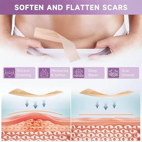 Silicone Scar Tape,Silicone Scar Sheets,Scar Tape For Surgical Scars,Silicone Scar Removal Strips For Surgical,C-Section,Tummy Tuck,Keloid Scars(1.6"X 60" Roll-1.5M) Keloid Bump Removal in Saudi Arabia