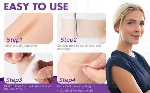Silicone Scar Tape,Silicone Scar Sheets,Scar Tape For Surgical Scars,Silicone Scar Removal Strips For Surgical,C-Section,Tummy Tuck,Keloid Scars(1.6"X 60" Roll-1.5M) Keloid Bump Removal in Saudi Arabia