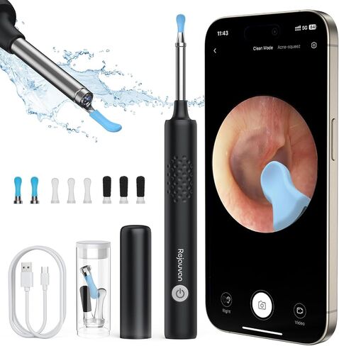 Ear Wax Removal, Ear Cleaner with Camera, Wireless Intelligent Visual Ear Picker, Earwax Removal Tool, 1080P HD Otoscope with 6 LED Lights, Ear Cleaner for iOS & Android (White) in Saudi Arabia