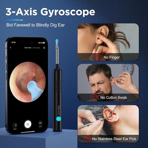 Ear Wax Removal, Ear Cleaner with Camera, Wireless Intelligent Visual Ear Picker, Earwax Removal Tool, 1080P HD Otoscope with 6 LED Lights, Ear Cleaner for iOS & Android (White) in Saudi Arabia