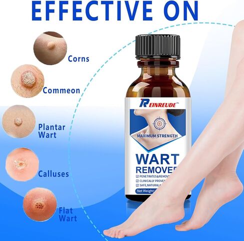 Strongest Wart Corn Remover Mask for Toes Fingers: Foot Wart Corn Removal for Feet Hands - Exclusive Formula Salicylic Acid Wart Off Mask for Plantar Wart, Common Wart, Flat Wart 30ml in Saudi Arabia