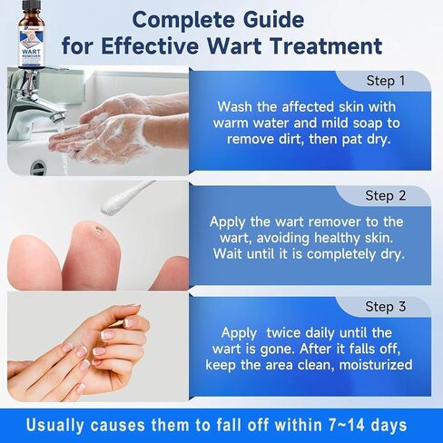 Strongest Wart Corn Remover Mask for Toes Fingers: Foot Wart Corn Removal for Feet Hands - Exclusive Formula Salicylic Acid Wart Off Mask for Plantar Wart, Common Wart, Flat Wart 30ml in Saudi Arabia