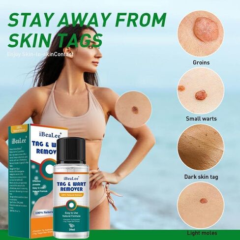 Wart Remover Liquid - 12% Wart Liquid with Salicylic Acid Botanical-Based Formula for Plantar and Common Warts.Suitable for People with Most Skin Types (1pack) in Saudi Arabia