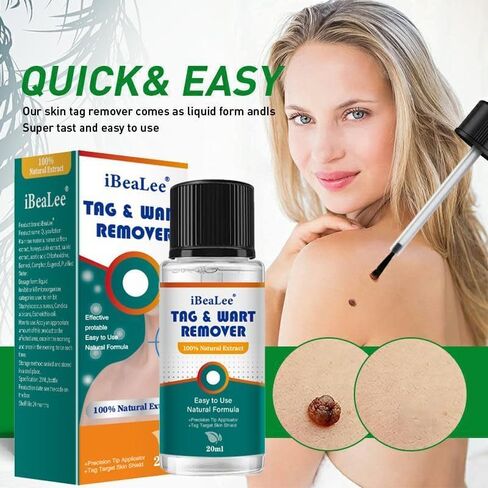 Wart Remover Liquid - 12% Wart Liquid with Salicylic Acid Botanical-Based Formula for Plantar and Common Warts.Suitable for People with Most Skin Types (1pack) in Saudi Arabia
