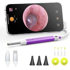 Digital Otoscope with Gyroscope, HD Ear Camera with Ear Wax Removal Tools, Video Ear Scope Otoscope with Light, Compatible with iPhone and Android (Silver)