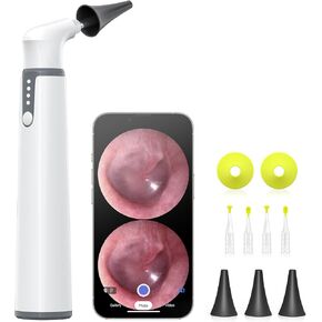 Wireless Otoscope with Gyroscope, Ear Camera with Dual View, 3.9 mm Otoscope with Light, Ear Scope with Ear Wax Removal Tool for Kids, Adults, and Pets, Compatible with iPhone and Android