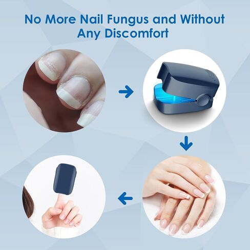 Nail Light 2025114 in Saudi Arabia