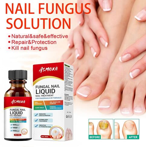 Toenail Fungus Treatment Extra Strength,Fungus Nail Treatment,Nail Fungus Treatment For Toenail,Athletes Foot Treatment,Toe Nail Fungus Treatments For Fungi Nail (1.01Fl Oz (Pack of 1)) in Saudi Arabia