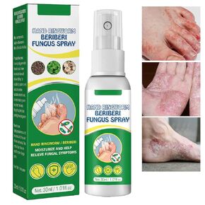 Athletes Foot Spray, Natural Foot Care for Itching & Odor Relief, Soothing Formula with Mint Oil & Botanical Extracts, Athletes Foot Spray Gentle Daily Use for Healthy Feet (60ml)