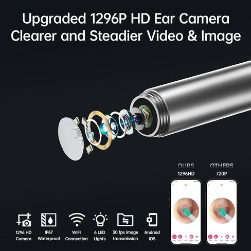 مجموعة إزالة شمع الأذن مع كاميرا 1296 بكسل، أداة إزالة شمع الأذن، مجموعة تنظيف الأذن، منظف الأذن مع كاميرا، منظار الأذن مع ضوء لهواتف iPhone وiPad وهواتف Android (أبيض) in Kuwait