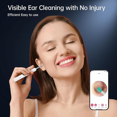 Ear Wax Removal - Ear Cleaner - Ear Wax Removal Tool Camera, Ear Cleaner with Camera, Ear Wax Removal Kit with 1296P Camera, Ear Cleaning Kit, Ear Camera Otoscope with Light(Black) in Saudi Arabia