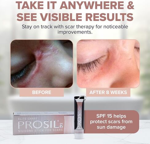ProSil Elite Carry with SPF 15 – Patented Scar Treatment in a Portable Keychain – Smooth Glide-On, Professional-Grade Silicone Scar Stick - Mess-Free, Travel-Friendly & Lightweight – Rose Gold Sleeve in Saudi Arabia