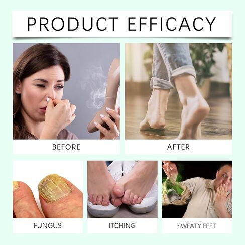 Foot Sanitizer Spray with Tea Tree Oil, Tea Tree Oil Feet Spray, Clear Foot Sanitizer Spray (2PCS) in Saudi Arabia