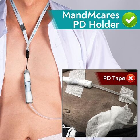 البريتوني غسيل الكلى النقل مجموعة الملحقات حامل القسطرة ل Baxter. PD Lanyard Necklace دعم دش آمن. (2 حاملي و 2 PCS قابلة للتعديل شبل الرقبة) (رمادي) in Kuwait