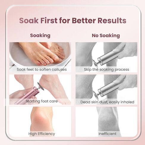 مزيل الكالس للقدمين ، فرك قدم احترافي مع 60 قطعة من أقراص ورق الصنفرة ، وأدوات باديكير السرعة القابلة للتعديل للأقدام ، ومزيل الكالس الكهربائي القابل للرجال للنساء البشرة الميتة والكالس in Kuwait