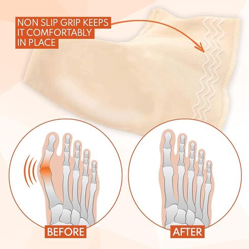 Bunion Corrector for Women & Men - Bunion Pads Relief Orthopedic Sock Cushion Sleeve Splint Gel Protector Support Brace w/ Non-Slip Grip - Bunion Remover Toe Guard - Fix Hallux Valgus Med. 2 Pcs in Saudi Arabia