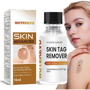 Skin Tag Remover,Wart Remover,Fast Acting Gel Remover Freeze Off -Fast-Acting Freeze Off - Wart Removal for Plantar, Genital Wart, H Warts, Flat Wart 1 Pack Yellow XXF