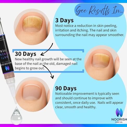 Toenail Fungus Treatment - Extra Strength - Fast Acting 3-in-1 Anti Fungal Liquid & Nail Repair - Doctor Formulated with Biotin & Retinol - 2 Treatment Pens with Glass Nail File - NOORISH FOOT CO. in Saudi Arabia