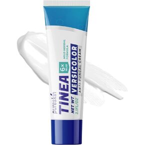 Tinea Versicolor Treatment Cream Extra Strength Antifungal - Clinically Proven Herbal Based - Soothing Relief for Athlete's Foot Jock Itch Dry Skin Ringworm 2.1 Oz