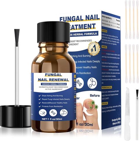 Toenail Fungus Treatment Extra Strength,Nail Fungus Treatment For Toenail,Athletes Foot Treatment,Ingrown Toenail Treatment,Toe Nail Fungus Treatments For Fungi Nail(1fl oz/30ml) in Saudi Arabia