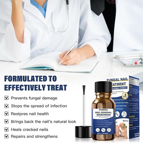 Toenail Fungus Treatment Extra Strength,Nail Fungus Treatment For Toenail,Athletes Foot Treatment,Ingrown Toenail Treatment,Toe Nail Fungus Treatments For Fungi Nail(1fl oz/30ml) in Saudi Arabia