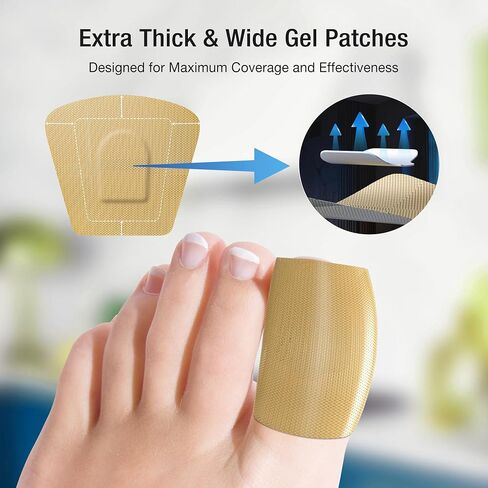Toenail Fungus Treatment Extra Strength Kit - 30ml Nail Repair Liquid Solution and 20 Hydrogel Patches, Nighttime Fungal Nail Treatment for Toe & Fingers, Fast-Acting Formula in Saudi Arabia