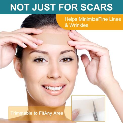 Silicone Scar Sheets for face, Silicone Scar Tape, Removal Strips for Surgical Scars 1.5" x 79" Medical Grade Silicone Scar Tape for C-Section, Tummy Tuck, Keloid (1 Roll 1.5" x 79") in Saudi Arabia