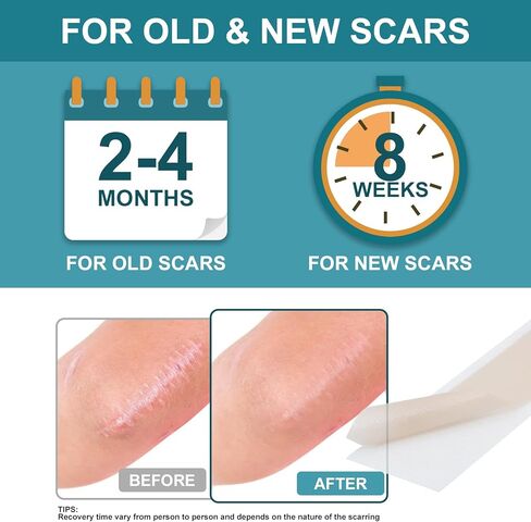 Silicone Scar Sheets for face, Silicone Scar Tape, Removal Strips for Surgical Scars 1.5" x 79" Medical Grade Silicone Scar Tape for C-Section, Tummy Tuck, Keloid (1 Roll 1.5" x 79") in Saudi Arabia