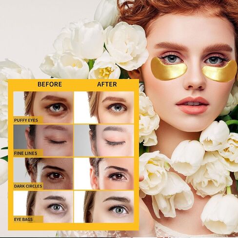 Under Eye Patches for Puffy Eyes Treatment 24 Pairs, 24K Gold Under Eye Masks for Dark Circles and Puffiness, Eye Gel Pads w/Collagen, Hyaluronic Acid, Rose Essence, Vitamins for Eye Bags Treatment in Saudi Arabia