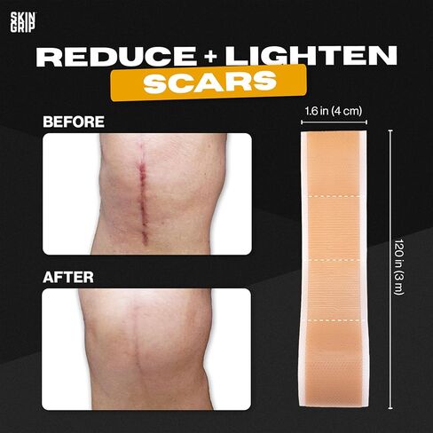 Skin Grip Medical Grade Silicone Scar Tape 1.6"x120" Roll - Increased Strength & Reduced Irritation - Silicone Scar Sheets For Face, Surgical Scars, C-Section, Keloid Treatment, Tummy Tuck, Burn, Acne in Kuwait
