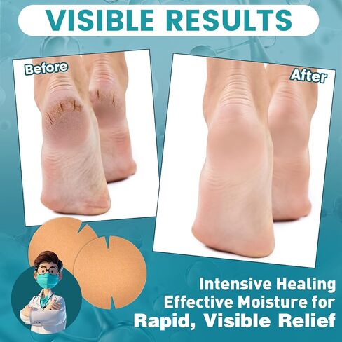 20PCS Patented Cracked Heel Treatment Patches, Cracked Heel Repair Bandage (100mm x 100mm) in Kuwait
