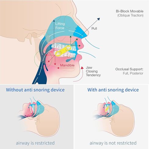 50pcs استبدال الأشرطة المرنة لتطبيق Meyson EMA (أصفر ، 21 مم) in Kuwait