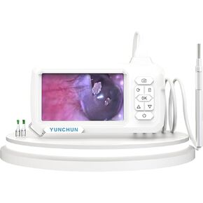 YUNCHUN Screen Endoscope is an Observation Magnifier with 1 million Pixel 3.9mm Camera 4.3-inch IPS Screen, Visual Ear Cleaner Ear Wax Removal Digital Otoscope 1920*1080P 2600mAh Rechargeable Battery