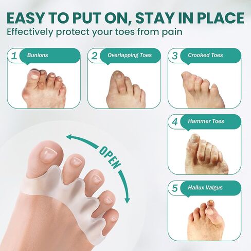 Welnove 10-Pack Toe Separator to Correct Bunions and Restore Toes to Their Original Shape, Bunion Corrector for Women Men, Toe Spacers for Gifts (White) in Saudi Arabia