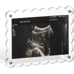 Magnetic Baby Ultrasound Scalloped Picture Frame Sonogram Clear Acrylic Photo Frame Display Baby Announcement for Gender Reveal Expecting Parents Pregnant