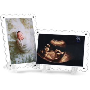2 Pack Magnetic Clear Acrylic Scalloped Ultrasound Picture Frames with Stand - Horizontal & Vertical Sonogram Display for Pregnancy Announcement, Gender Reveal - Dual Sided Keepsake for New Parents