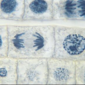 Fish And Onion Mitosis Microscope Slide And Study Guide Set, Compare Plant And Animal Mitosis