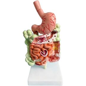 نموذج الجهاز الهضمي البشري نموذج تشريح المعدة الأمعاء cecum المستقيم druodenum النموذج الأعضاء الداخلية البشرية