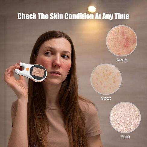 Handheld Dermatoscope Skin Analyzer Machine, Wireless Portable Digital Microscope with 1080P IPS Screen 8 LEDs, 500X Magnifier, for Scalp/Hair Trichomes Facial Skin Dermatoscope in Saudi Arabia