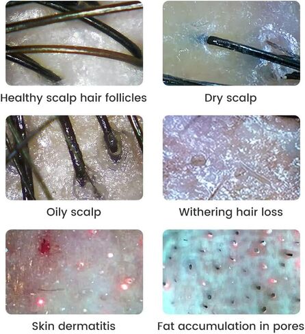 Handheld Dermatoscope Skin Analyzer Machine, Wireless Portable Digital Microscope with 1080P IPS Screen 8 LEDs, 500X Magnifier, for Scalp/Hair Trichomes Facial Skin Dermatoscope in Saudi Arabia