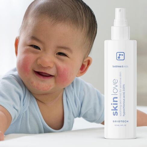 Briotech Babies & Kids Skin Love ، رذاذ حمض hypochlorous المهدئ ، هوكل نقي للبشرة الحساسة ، الاحمرار الهادئ والمطبات ، الدعم ضد تهيج حفاضات ، لطيف ونباتي ، حجم سفر 2 أوقية. in Kuwait
