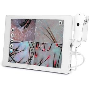 Skin Diagnosis Hair Analyzer, Skin Hair Analyze, Configure Dual Lens,32g of Large Memory,Used to Detect Skin and Hair Health Status