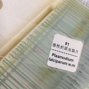 Plasmodium Falciparum Smear Prepared Microscope Slides 1 Pieces