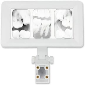 Xray Film Viewer Film Illuminator Light Mini Oral Hygiene Panorama Viewbox Tools