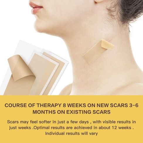 [صندوق مكون من 8] أوراق إزالة الندبات من السيليكون، شريط سيليكون احترافي (5.9 بوصة × 1.6 بوصة) للندبات والجُدرات الناتجة عن الحروق والصدمات والجراحة والقسم القيصري، رقعة إزالة الندبات الجدرة قابلة لإعادة الاستخدام وقابلة للغسل in Kuwait