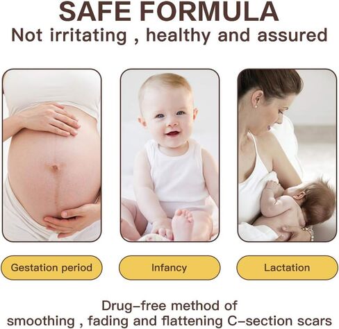 [صندوق مكون من 8] أوراق إزالة الندبات من السيليكون، شريط سيليكون احترافي (5.9 بوصة × 1.6 بوصة) للندبات والجُدرات الناتجة عن الحروق والصدمات والجراحة والقسم القيصري، رقعة إزالة الندبات الجدرة قابلة لإعادة الاستخدام وقابلة للغسل in Kuwait