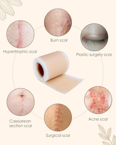 أوراق الندبات المصنوعة من السيليكون (1.6 بوصة × 60 بوصة)، لفافة شريط الندبات، شرائط الندبات الطبية، أوراق إزالة الندبات من السيليكون للقسم القيصري، الحروق، شد البطن، وشفاء الجدرة in Kuwait