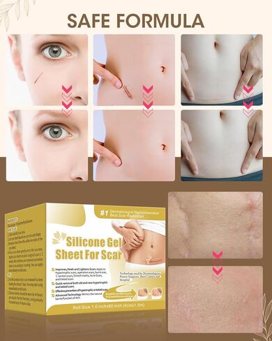 أوراق الندبات المصنوعة من السيليكون (1.6 بوصة × 60 بوصة)، لفافة شريط الندبات، شرائط الندبات الطبية، أوراق إزالة الندبات من السيليكون للقسم القيصري، الحروق، شد البطن، وشفاء الجدرة in Kuwait