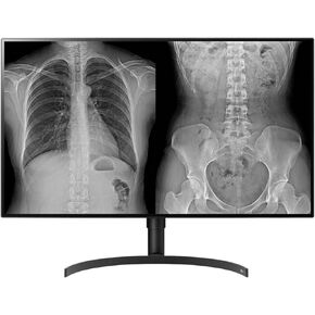 LG 32HL512D-B 31.5" 4K LCD Monitor - 16:9 - TAA Compliant